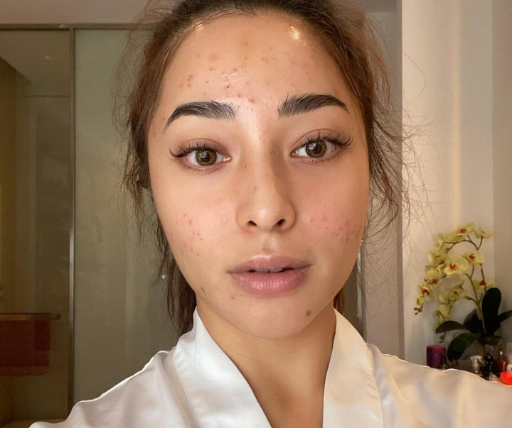 Nikita Willy Nangis Tiap Malam hingga Menolak Syuting Gara-Gara Hal Ini