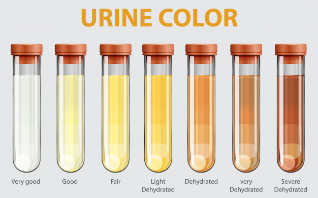Inilah Arti dari Warna yang Berbeda-beda pada Urine
