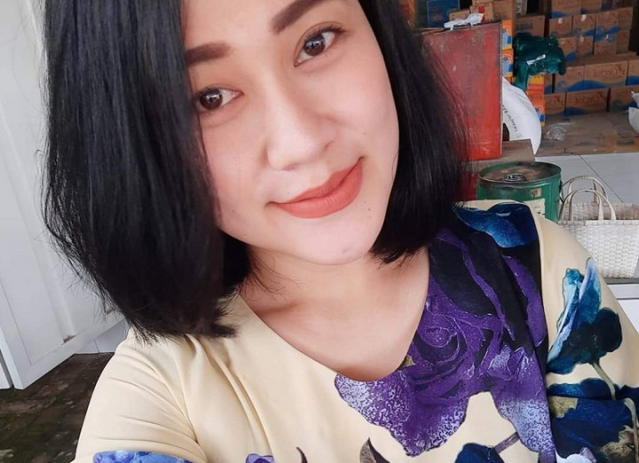 Perawat Disiram Pertalite Alami Luka Bakar 60% di Wajah