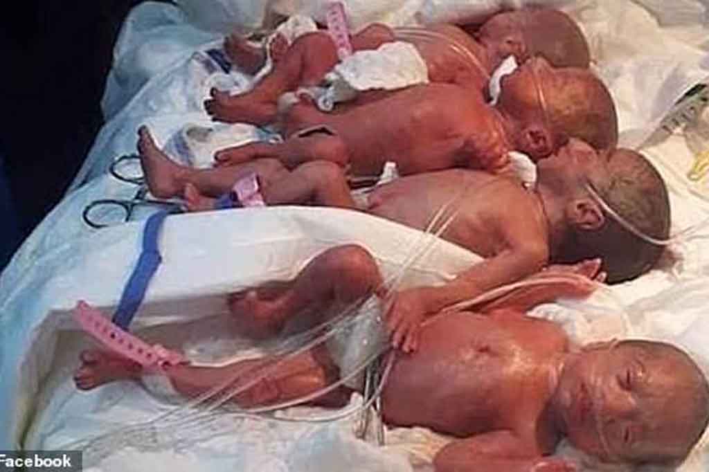 Kejadian Langka, Perempuan di Mali Lahirkan Bayi Kembar Sembilan