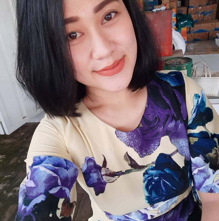 Kondisi Perawat Dibakar di Malang Berangsur Membaik