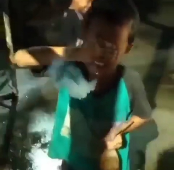 Bakar Petasan di Mulut, Aksi Bocah Ini Bikin Ngilu