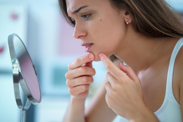 Beragam Cara Mengatasi Jerawat Hormonal dengan Bahan Alami