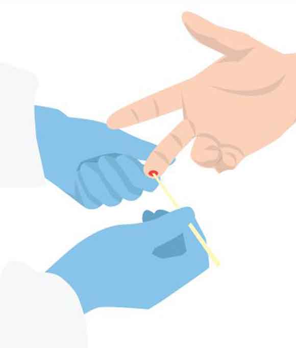 Deteksi Korona dengan Nanopartikel Fluoresensi