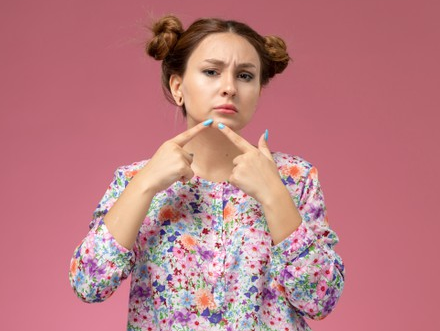 Kenali Jerawat karena Stres dan Cara Mencegahnya