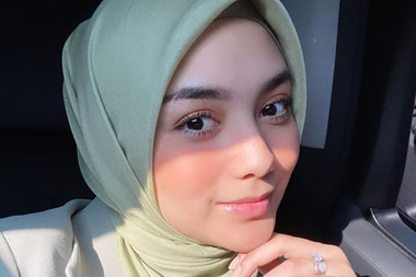 Ubah Pola Hidup, Bobot Citra Kirana Berkurang 22 Kilogram