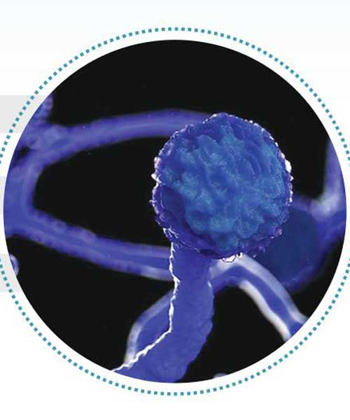 Jamur Hitam Muncul ketika Imun Kolaps