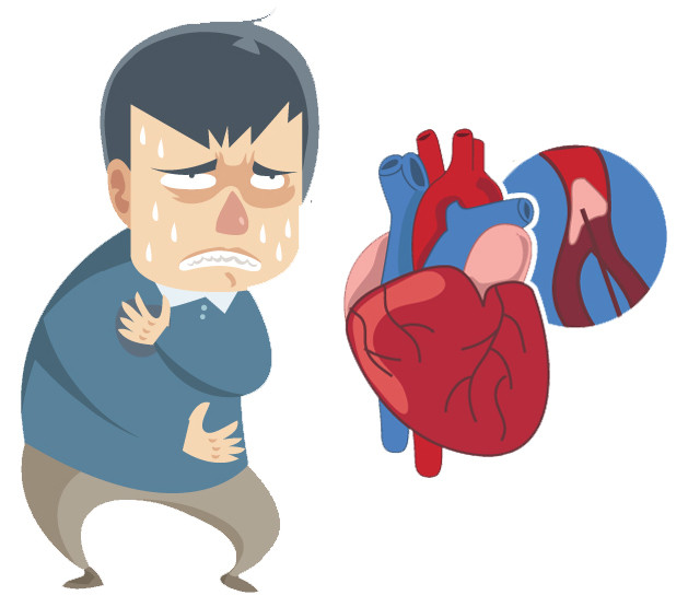 Mengenal Cardiac Arrest