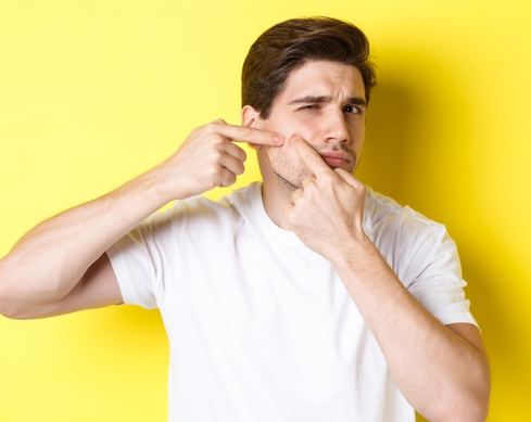 5 Jenis Jerawat yang Perlu Kamu Ketahui