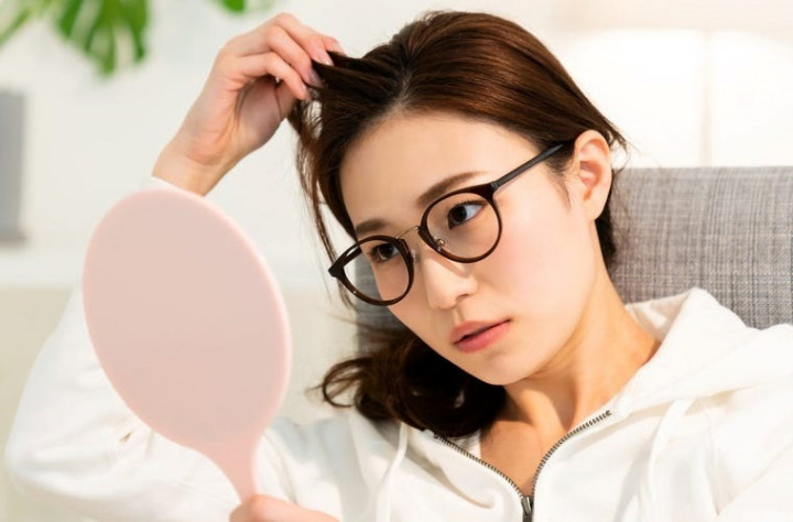 Mengapa Timbul Jerawat di Kulit Kepala? Berikut Ini Cara Mengatasinya