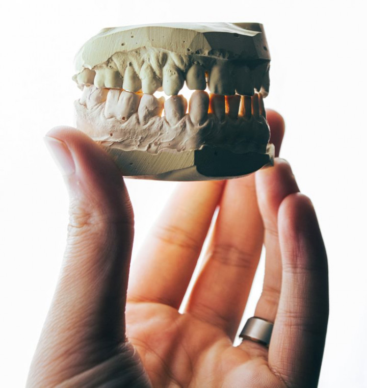 7 Penyebab Bercak Cokelat Muncul pada Gigi