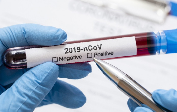 Penyedia Jasa Langgar Batas Tarif PCR? Siap-siap Ditindak Tegas