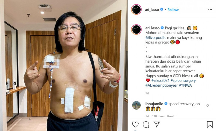 Kondisi Ari Lasso Pasca Operasi: Perut Diperban sampai Nonton Liverpool