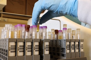 Jepang Sepakati Pembelian 150 Juta Dosis Vaksin Covid-19 Novavax