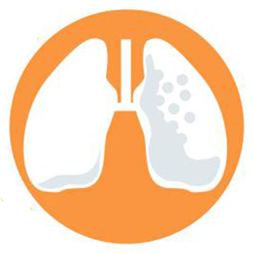 Membentengi Diri dari Risiko Kanker