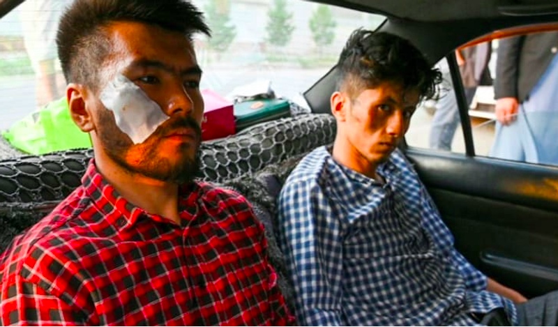 Dua jurnalis Afghanistan yang dipukuli Taliban. Foto: AFP