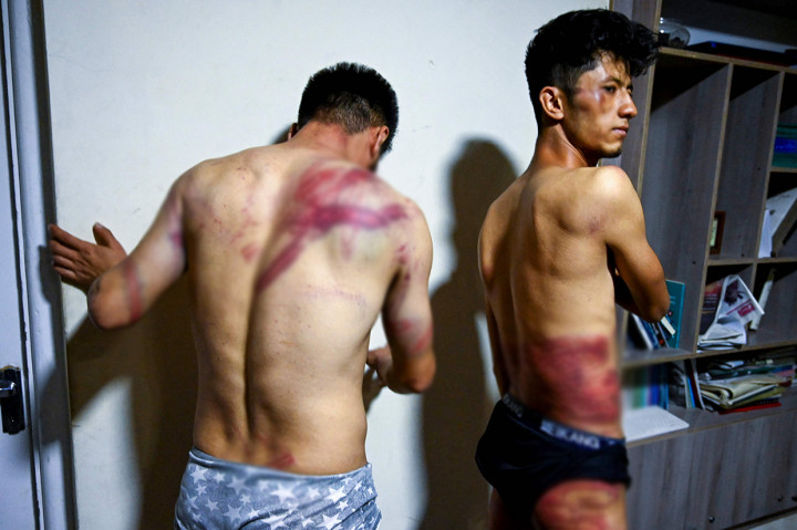 Duh! Jurnalis Afghanistan Dipukuli Taliban hingga Memar Parah