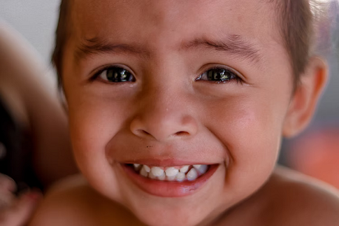 Tidak hanya bebas infeksi, orang tua juga perlu memperhatikan gigi anak agar memiliki bentuk, ukuran dan posisi yang tepat pada tempatnya. (Foto: Ilustrasi. Dok. Unsplash.com)