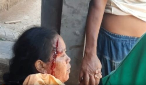 Serangan Kera Liar di Magetan Melukai Seorang Warga