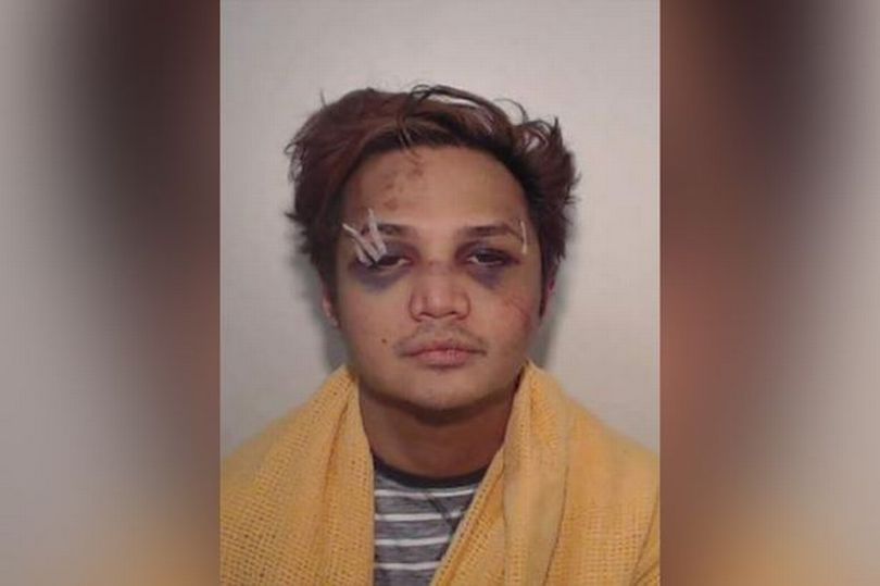 Predator seksual Reynhard Sinaga dengan wajah babak belur (Foto Dok GMP)