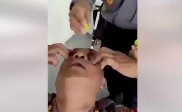 [Cek Fakta] Benarkah Meneteskan Air Jeruk Nipis ke Mata Dapat Mengurangi Minus? Cek Faktanya