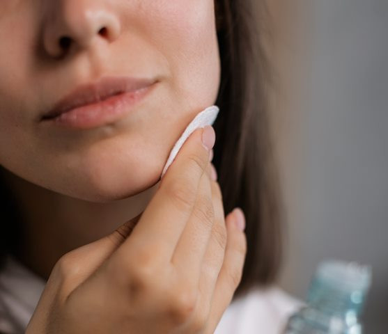 Cara Alami Enyahkan Komedo dari Wajah Sampai Tubuh