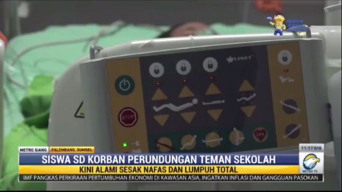 Dianiaya Teman, Siswa SD di Sumsel Terancam Lumpuh