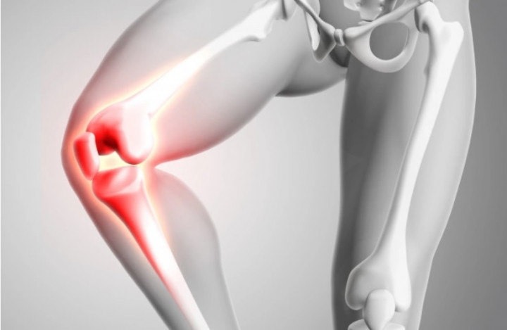 Cara Pengobatan Kelainan Bentuk Tulang dengan Limb Lengthening & Reconstruction