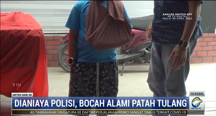 Dianiaya Polisi, Bocah di Mamasa Alami Patah Tulang