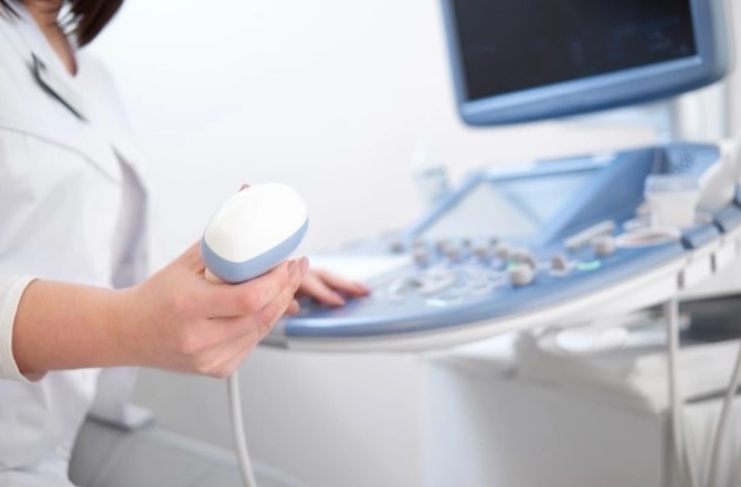 Ketahui Cadangan Ovarium untuk Keberhasilan Program Bayi Tabung