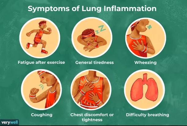 Penyebab Radang Paru serta Cara Pengobatannya