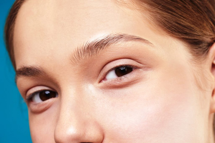 5 Bahan Alami untuk Mengatasi Mata Bengkak