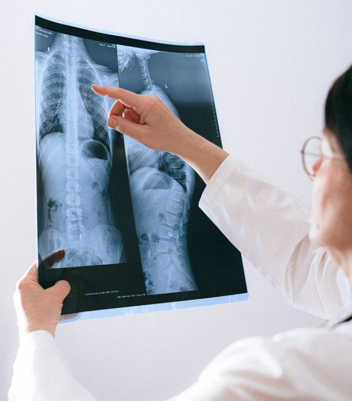 Ketahui Tipe Kanker Paru NSCLC Serta Perawatannya