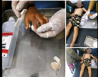 [Cek Fakta] Beredar Foto Seorang Anak Lolos dari Penculikan? Begini Faktanya