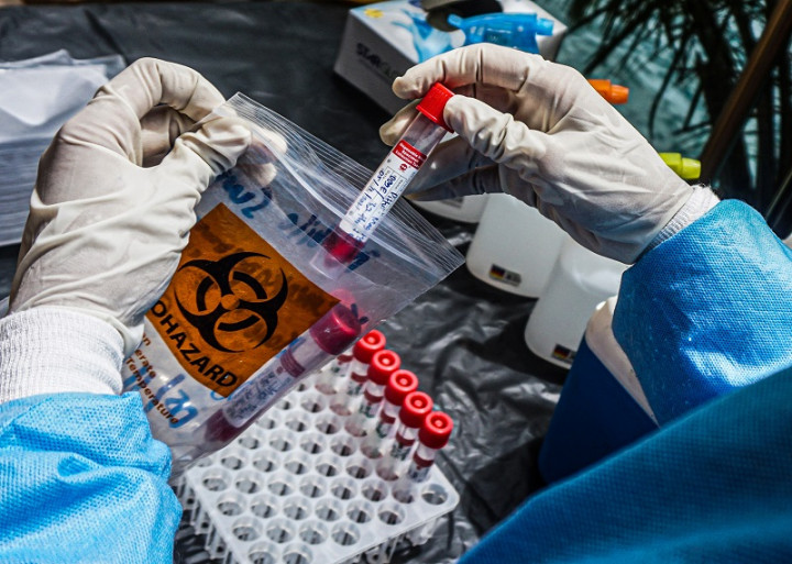 Antisipasi Omicron, Satgas Covid-19 Jatim Awasi Ketat Sampel Swab PCR