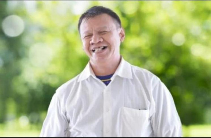 Sebelum Meninggal, Kepala Jimmy Gideon Berdarah Akibat Terjatuh