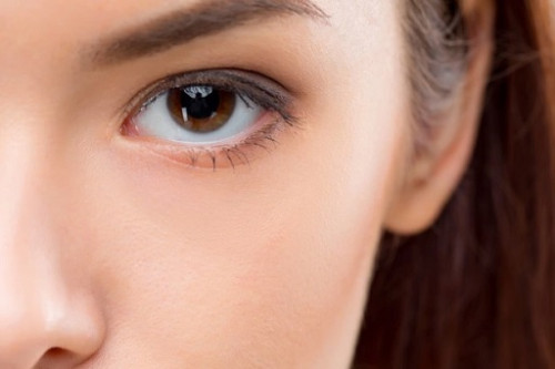  Mata bengkak biasanya muncul sebagai pembengkakan ringan pada kelopak mata atas dan bawah. (Foto: Ilustrasi. Dok. Freepik.com)