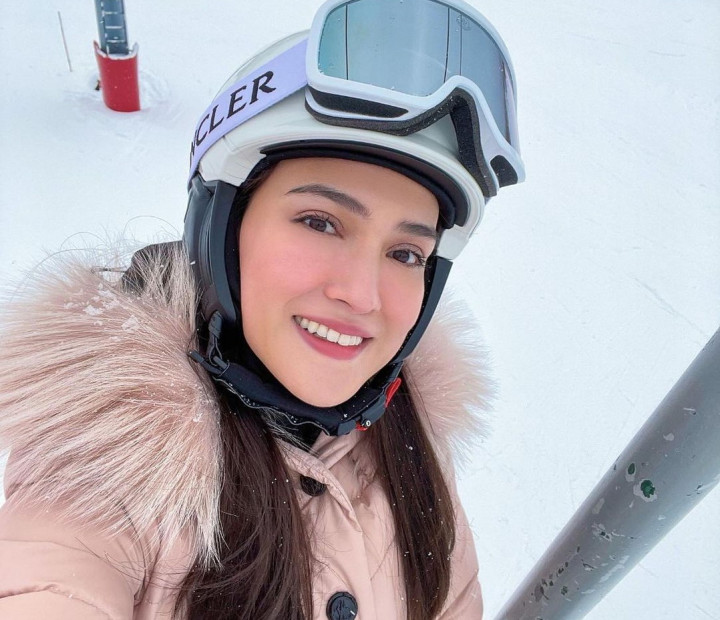 Shandy Aulia Gemas dengan Reaksi Suami saat Melihatnya Terjatuh