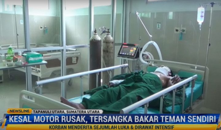 Pemuda Bakar Teman Sendiri Gara-gara Kesal Motor Dirusak