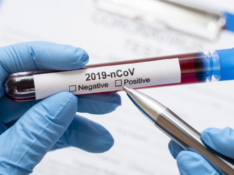 Biaya Tes Covid-19 Pakai RT Lamp Disebut Lebih Murah Ketimbang PCR