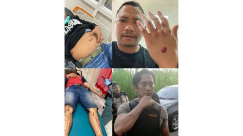 4 Polisi di Probolinggo Terluka Diserang Begal dengan Bom Bondet