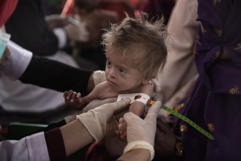 Some 22.8 million people are at risk of acute food insecurity, according to UN estimates. (Photo:UNICEF)