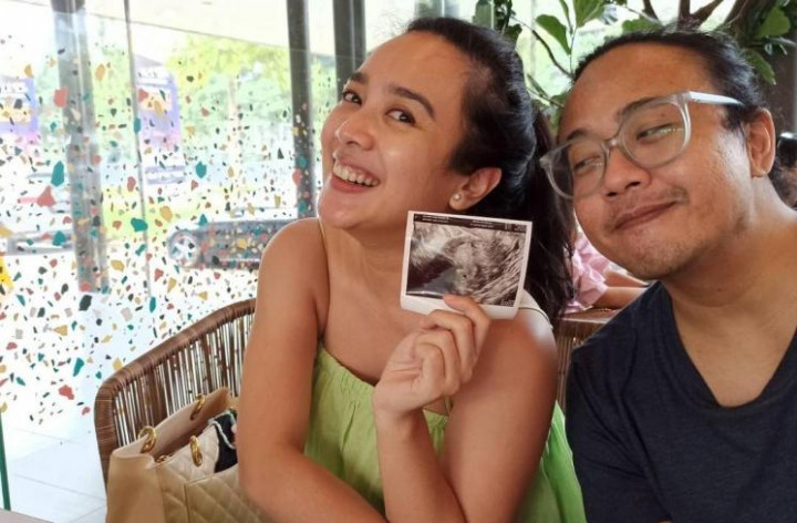 Dea Ananda Jawab Rumor Operasi Plastik Bareng Ariel