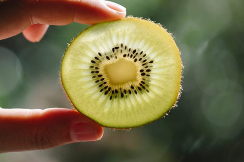 Dr. Nadia Alaydrus memberikan penjelasan tentang makan buah kiwi dengan kulitnya. (Foto: Ilustrasi/Unsplash.com)