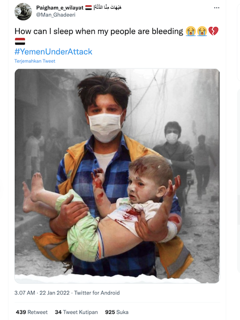 [Cek Fakta] Beredar Foto Anak Berlumuran Darah Korban Serangan di Yaman? Begini Faktanya