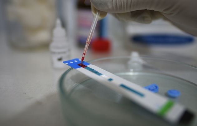 Research Reveals Existence of More Transmissible, Damaging Variant of HIV