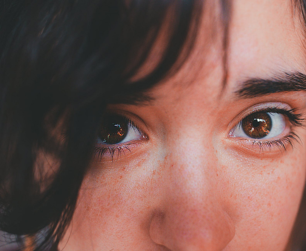 Permasalahan kehatan kulit kerap dialami remaja, salah satu yang paling umum adalah jerawat. (Foto:Pexels)