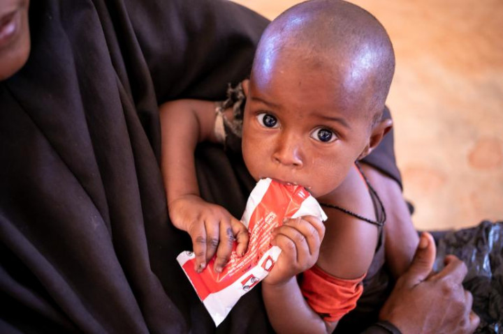 Over 1.4 Million Children in Somalia Likely to Suffer from Malnutrition: UNICEF