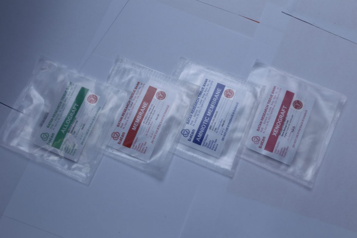 Membran Perikardium Iradiasi untuk Perawatan Gigi Hasil Riset BRIN Bakal Diproduksi Komersial