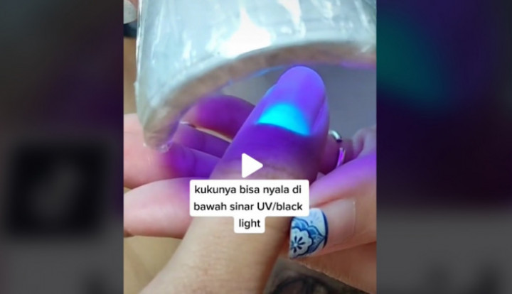 Kuku Penyintas Covid-19 Menyala di Bawah Sinar UV, Ini Tanggapan Dokter RSA UGM